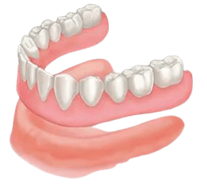 Traditional Dentures